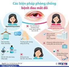 Khuyến cáo đau mắt đỏ của Bộ y tế